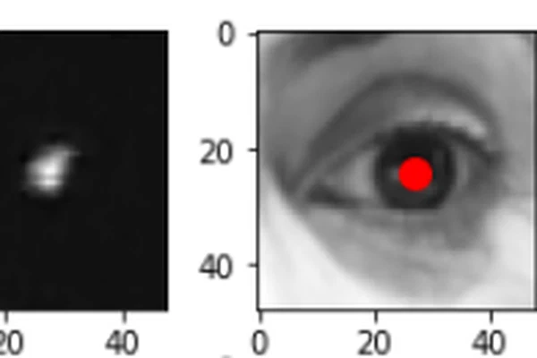 Human Iris Detection